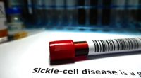 Those suffering from sickle cell disease may finally be getting some relief as experts work on cure