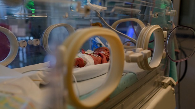 Premature births continue to rise for Black, Native American mothers: Report