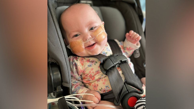 Baby born at 23 weeks gets special surgery to fix incomplete esophagus